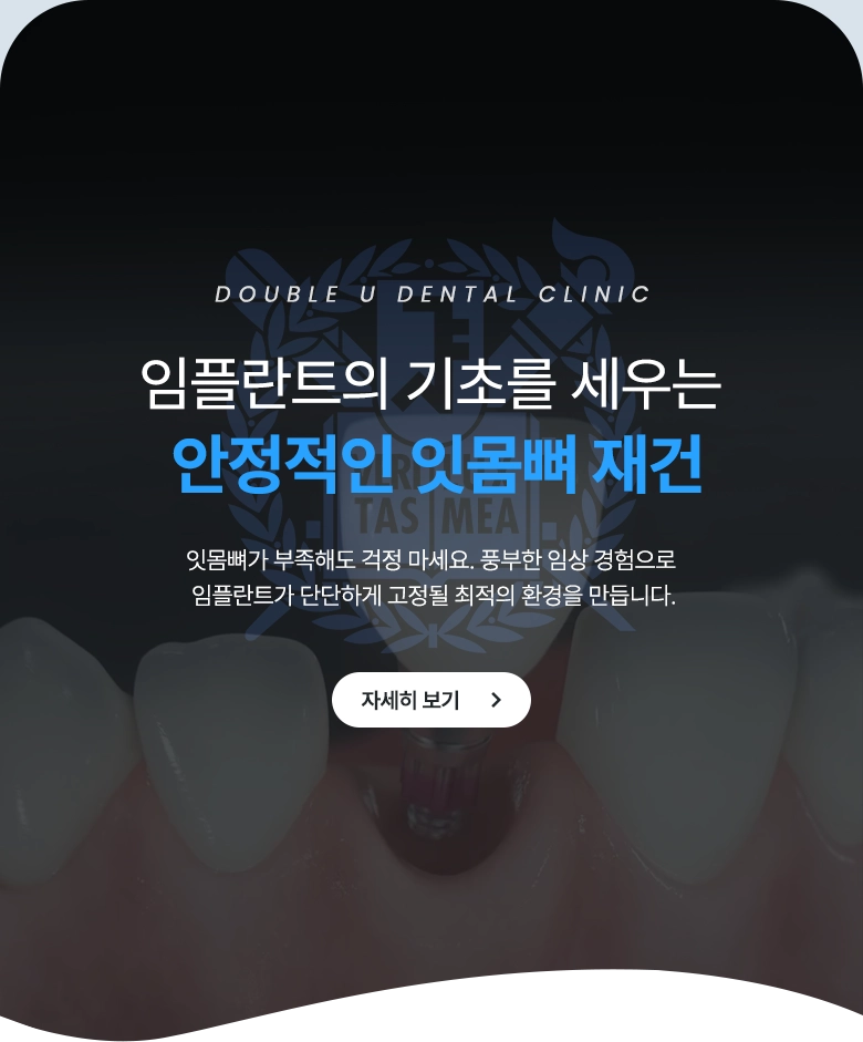 임플란트의 기초를 세우는 안정적인 잇몸뼈 재건 / 잇몸뼈가 부족해도 걱정 마세요. 풍부한 임상 경험으로 임플란트가 단단하게 고정될 최적의 환경을 만듭니다. / 자세히 보기