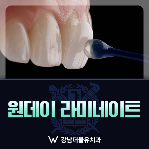 원데이 라미네이트 진료 정보